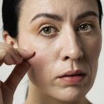 Early Signs of Skin Aging