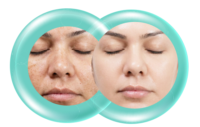 CEL Oxygenic E-Before After
