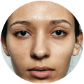 Dull, Tired-Looking Complexion